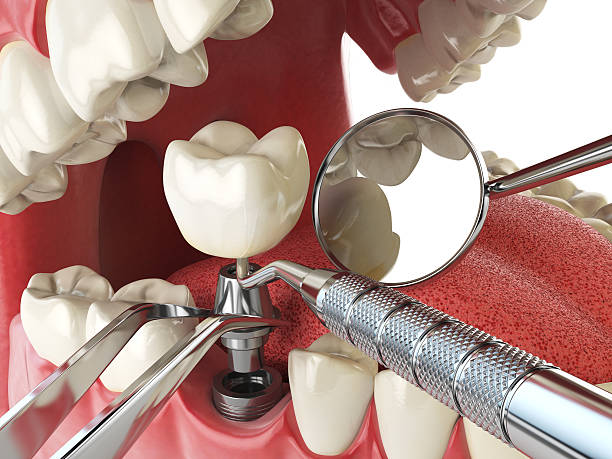 Best Emergency Tooth Extraction  in Grove City, OH